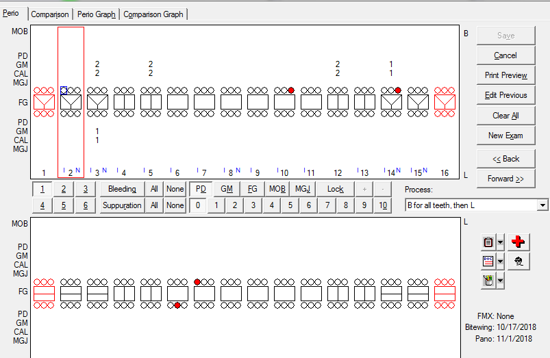 Perio Chart